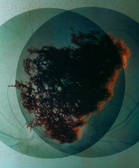 Atmos, Synthesis by Alexandra von Fuerst